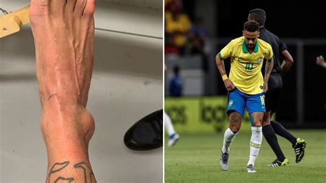 Neymar ruled out of action for four weeks due to ankle injury | MARCA in English