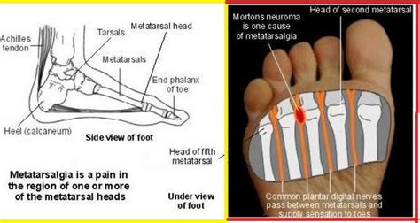 Pin on Health