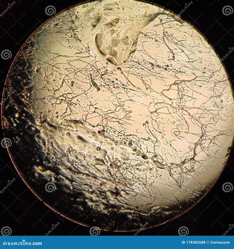 Alternaria Fungal Mycelium Under the Microscope Stock Photo - Image of ...