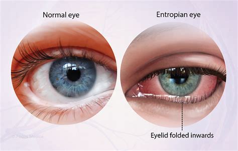 Health Condition : Symptoms, Causes, Treatment and More