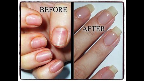 Why Are Acrylic Nails Bad For You at Mark Jones blog