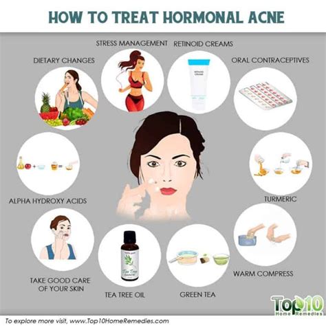 How to Treat Hormonal Acne - #acne #Hormonal #Treat | Hormonal acne ...