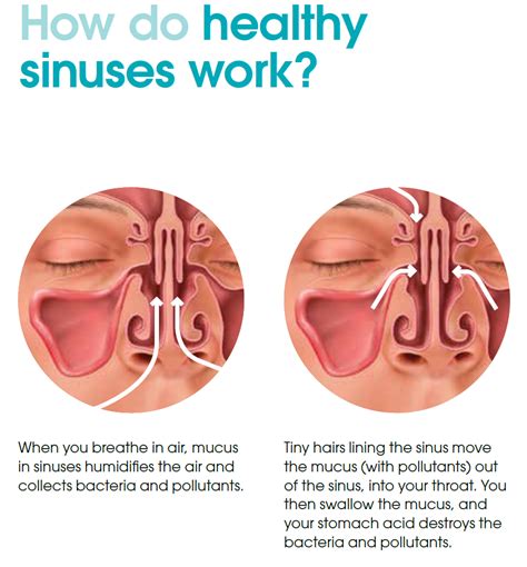 Sinus Problems - Dr. James Go