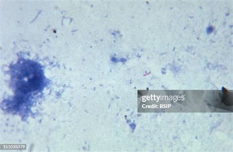 80 Tuberculosis Microscope Stock Photos, High-Res Pictures, and Images ...