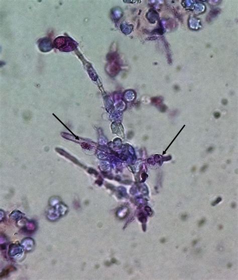 Macrophage Phagocytosis Microscope