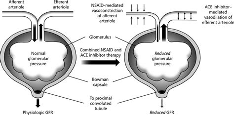 Pharmacology 101: An Overview of ACE Inhibitors — tl;dr pharmacy