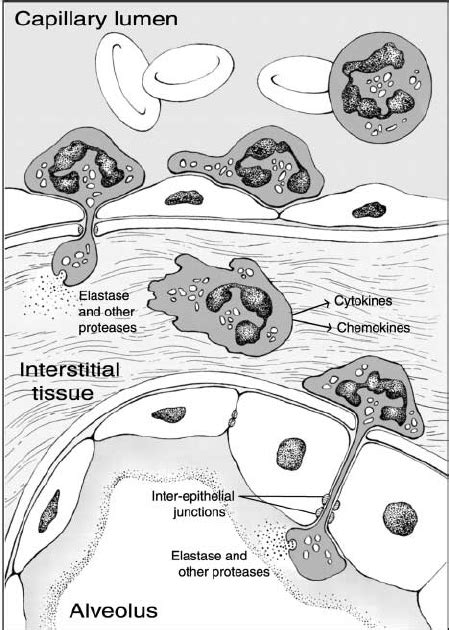 Elastase in the genesis of inflammatory tissue injury. There are ...