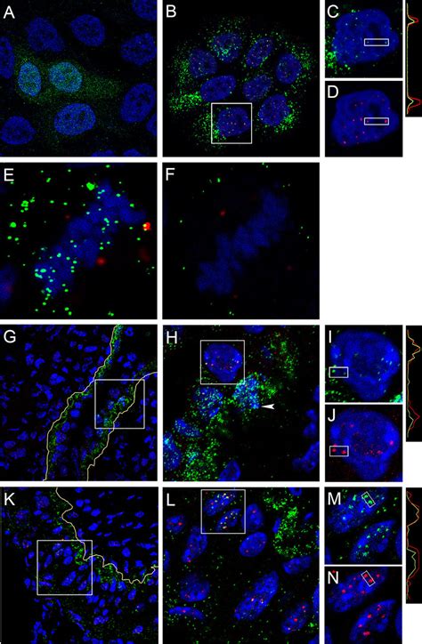 Nuclear L1 detected in keratinocytes. (A to D) HaCaT cells were ...