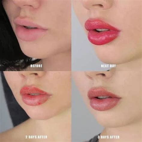 Lip Blushing Treatment Service, Lip Augmentation - Green Studio Group, Vellore | ID: 26565711562