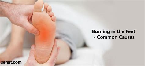 12 Most Common Causes Of Burning In The Feet