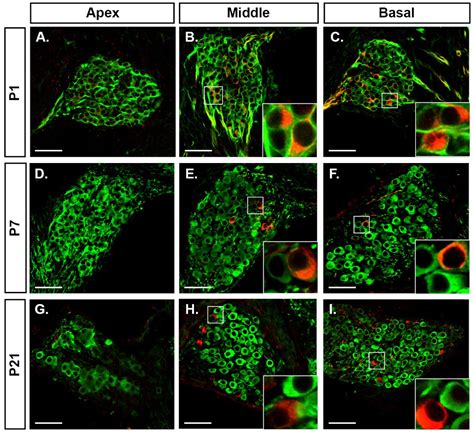 Type I vs type II spiral ganglion neurons exhibit differential survival ...