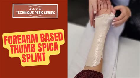 How to Create a Forearm-Based Thumb Spica Splint | Technique Peek Series - YouTube