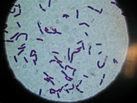 Lebensmittelvergiftung durch Bacillus cereus-Bakterien - MedDe