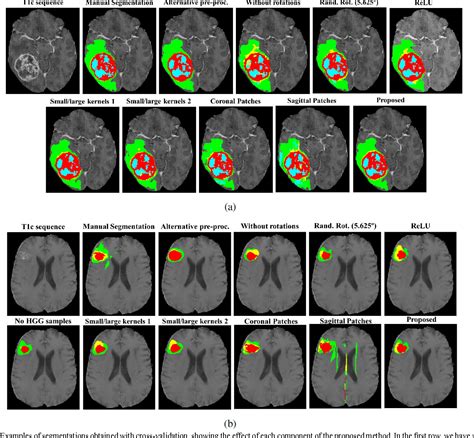 Brain Tumor Classification In Mri Image Using Convolutional Neural | sexiezpix Web Porn