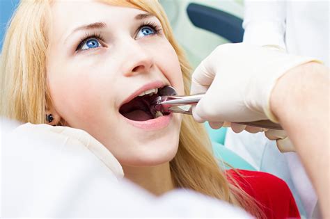 5 Tips for Stopping Post Tooth Extraction Bleeding - Finding Farina