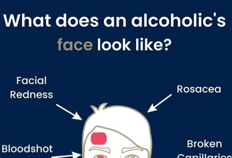 What Does an Alcoholics Face Look Like? - Abbeycare