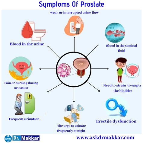 Prostrate Benign Prostatic Hyperplasia Hypertrophy Homeopathic Treatment BPH Benign tumour of ...