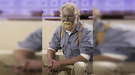 Bizarre ‘Papa Smurf’ resurfaces on the internet; know how overuse of ...