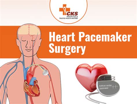 heart pacemaker surgery procedure