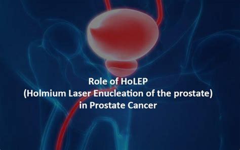 Holep treatment in India for prostate cancer, Hospitals - HBG