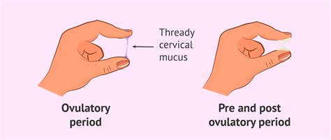 Fertile Cervical Mucus