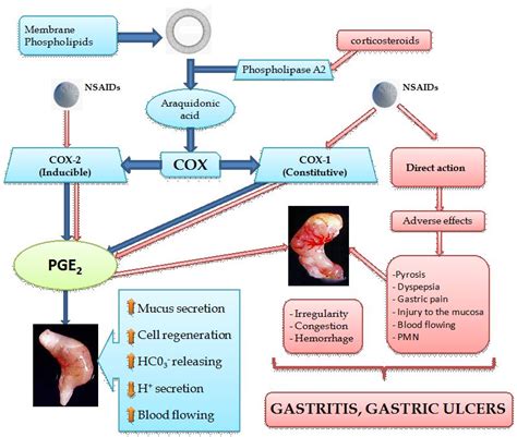 New Approaches in Gastritis Treatment | IntechOpen