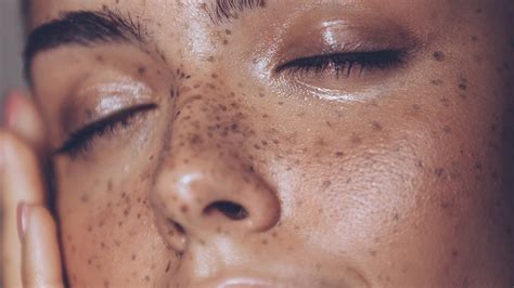 What Causes Oily Skin? 9 Reasons Your Skin Is so Oily - L’Oréal Paris