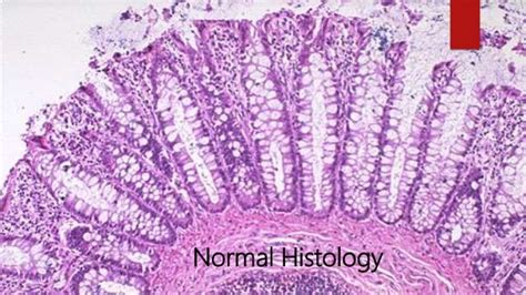 Radiology pathology correlation nov'18