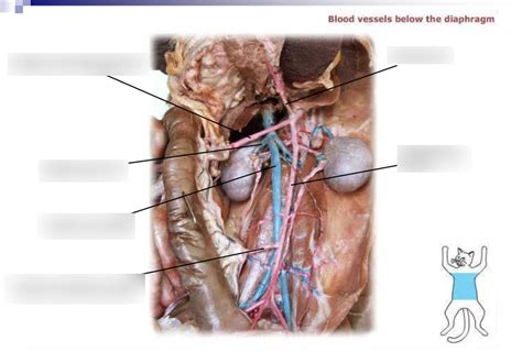 Celiac Trunk-Cat Arteries Diagram | Quizlet