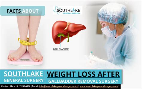 Gallbladder Removal