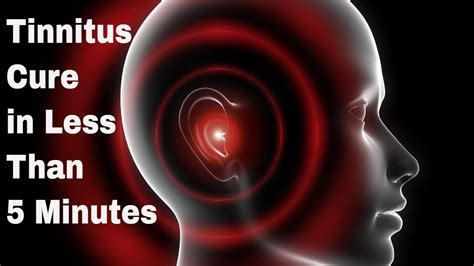 Is There Any Cure For Tinnitus 2024 - Reggi Charisse