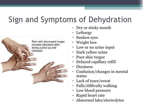 Pin by Ana Quiroz on senales de deshidratacion | Dehydration symptoms, Signs and symptoms, Symptoms