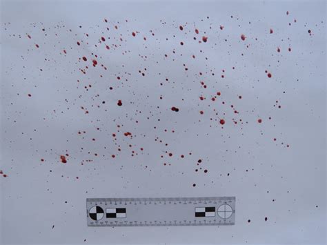 Blood Spatter Pattern Analysis – UCVision