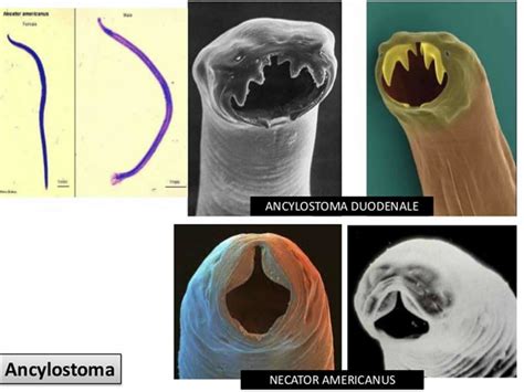 Hookworm infection, symptoms, diagnosis & hookworm treatment in humans