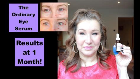 The Ordinary Eye Serum - Before & After Photos - 1 Month Results - YouTube