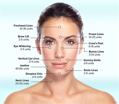 BOTOX in the San Francisco Bay Area