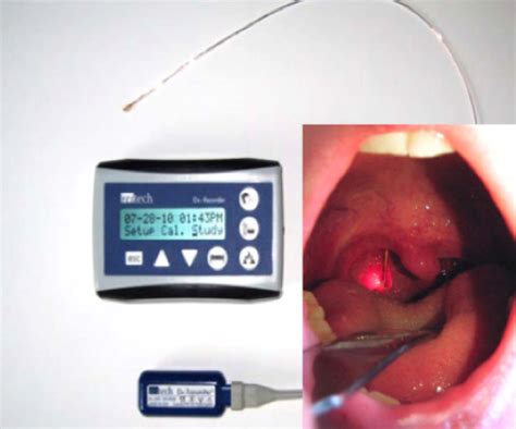 Laryngopharyngeal pH Monitoring (Restech) may predict a successful surgical outcome for ...