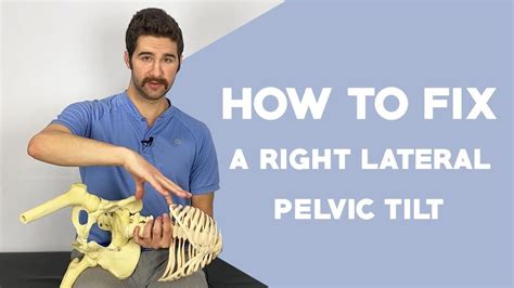 Right Lateral Pelvic Tilt Correction (EASY 5-Step Guide) (NOT the ...