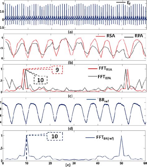 Figure 8 from Development of a real-time breathing-rate monitor using difference operation ...