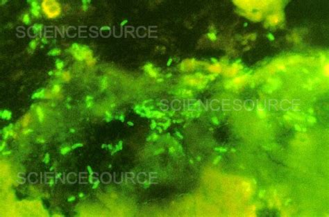 Photograph | Escherichia coli, DFA Stain, LM | Science Source Images