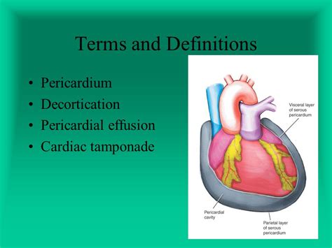 Pericardial Window Procedure Steps