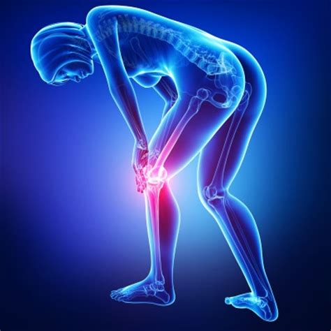 Migratory Joint Pain | All Star Pain Management & Regenerative Medicine