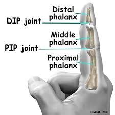 DIP Joint Osteoarthritis: How to Treat this Common Form of Arthritis