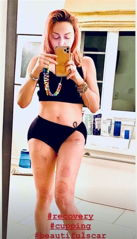 Madonna, 62, Bares Her Hip Scar and Cupping Marks in Underwear Selfie