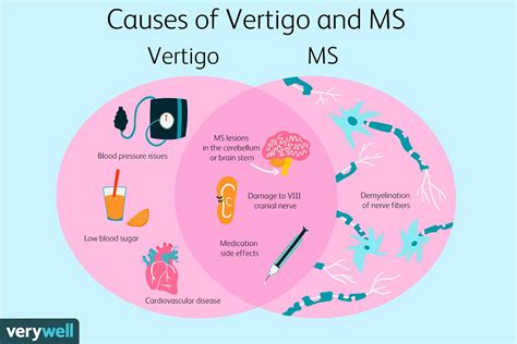 Vertigo in MS: Symptoms, Causes, Diagnosis, and Treatment