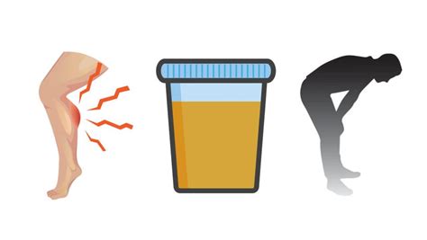 Signs and Symptoms of Rhabdomyolsis | Rhabdomyolysis | CDC