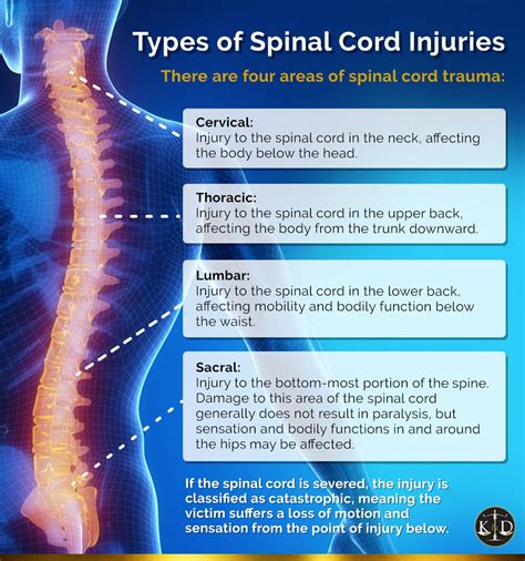 Long Beach Spinal Cord Injury Attorneys West Coast Trial, 55% OFF