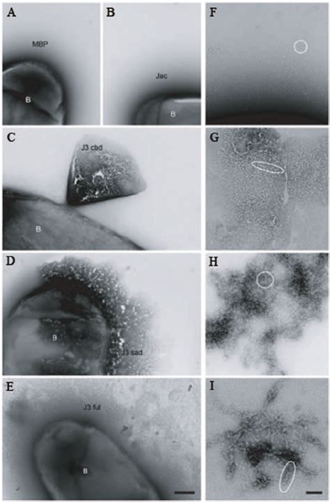 Negative stains of bacteria transformed with MBP constructs targeted to... | Download Scientific ...