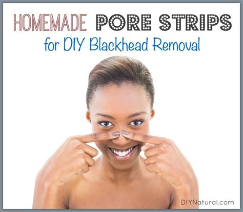 DIY Pore Strips: A Natural Homemade Way to Remove Blackheads