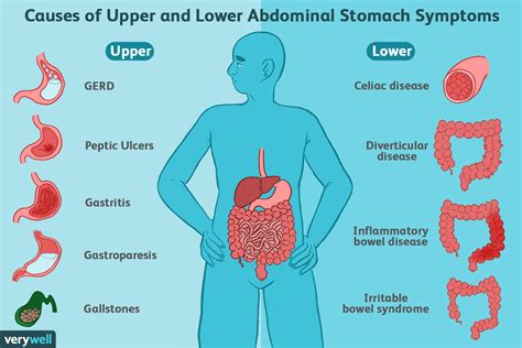 Symptoms of Common Stomach and Digestive Problems | Digestive system ...